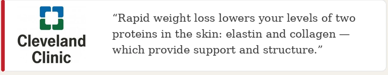 Cleveland Clinic on collagen and elastin loss